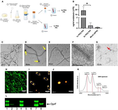 Bacterial outer membrane vesicles bound to bacteriophages modulate neutrophil responses to bacterial infection